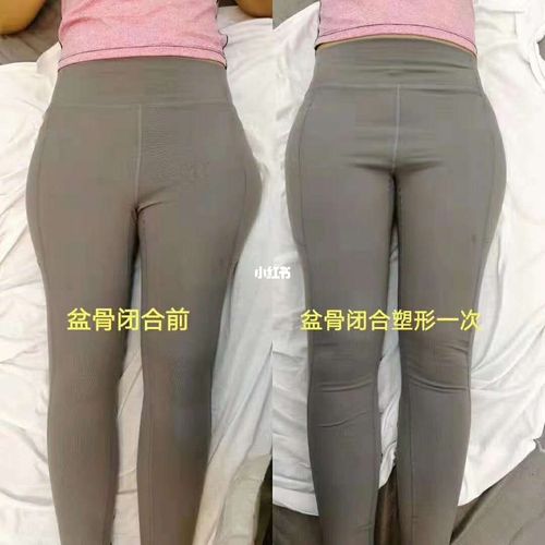 新澳門開獎(jiǎng)記錄新紀(jì)錄和女性盆骨正在縮小與女性盆骨正在縮小怎么回事