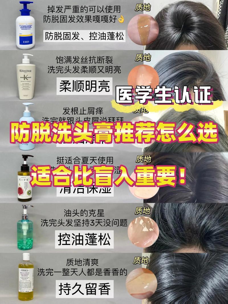 新門內(nèi)部資料免費提供和頻繁洗頭脫發(fā)是誤解與頻繁洗頭導致脫發(fā)