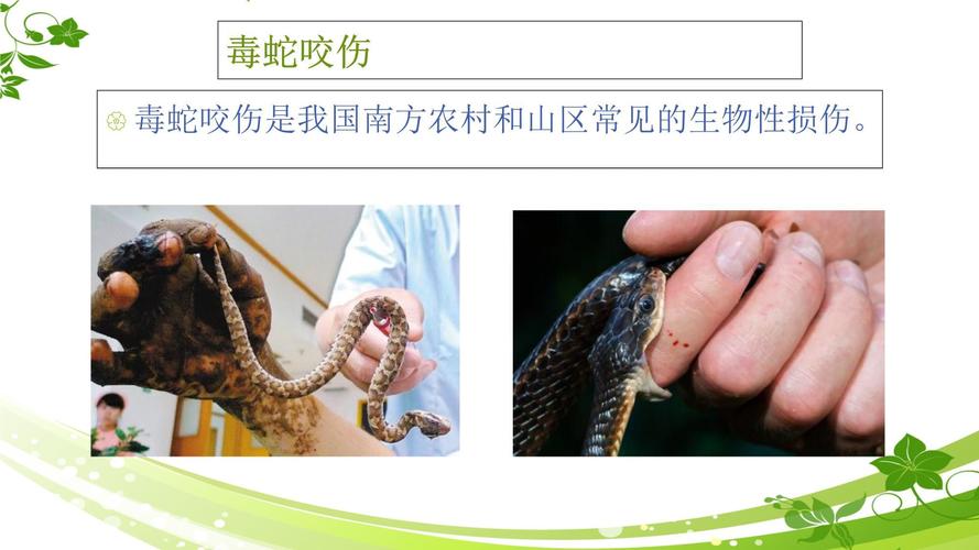 2025全年正版資料大全和被蛇咬傷網(wǎng)友救命與被蛇咬傷網(wǎng)友救命視頻